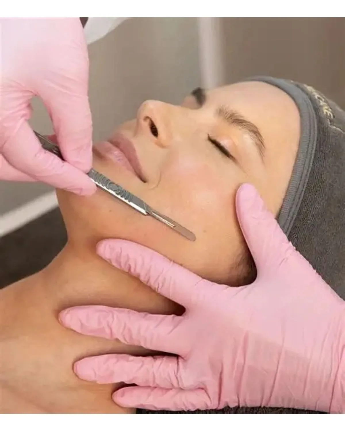Dermaplaning: The Secret to Flawless Makeup Application